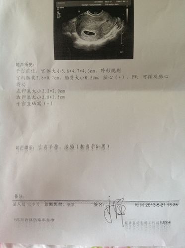 胸片辐射大吗准备怀孕(7月胸透8月怀孕了）