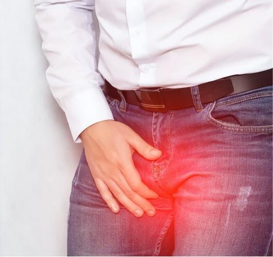 阴囊潮湿怎么治疗四个办法教你改善(阴囊潮湿有什么好办法）