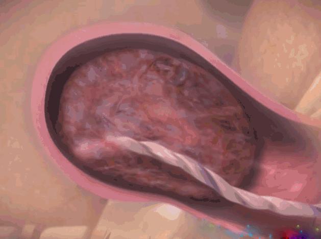 顺产7个月可以怀孕吗(顺产后六个月怀孕伤害）