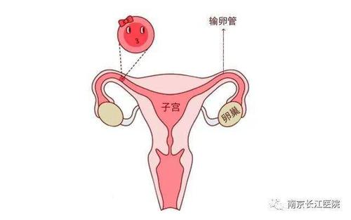 输卵管手术后备孕多久(一侧输卵管如何备孕）