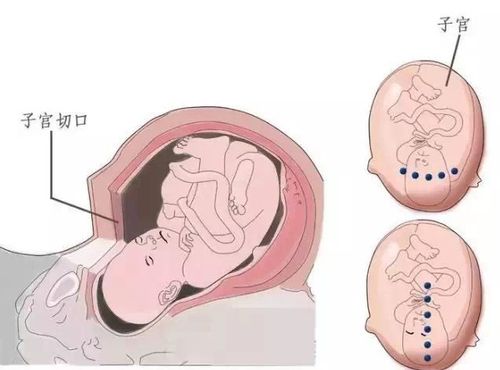 顺产多久后可以怀孕(怀孕多走路真的能很快顺产吗）