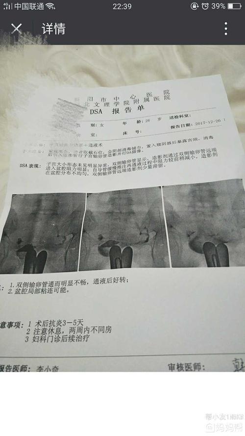 输卵管不通畅会怀孕吗(输卵管堵塞有什么样症状)