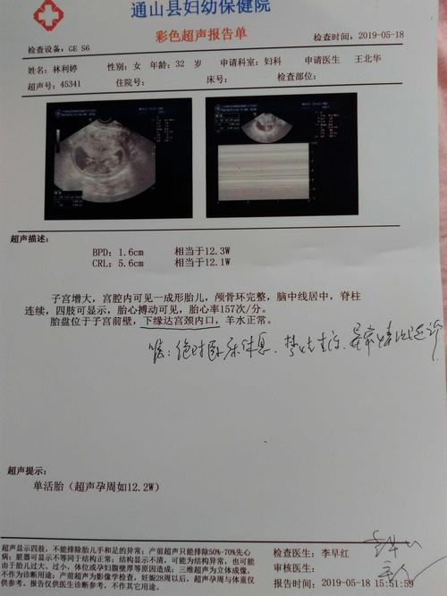 胸透后多久可以怀孕(7月胸透8月怀孕了）