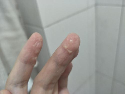 豆腐渣白带是怀孕了吗