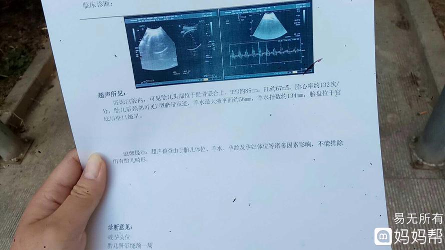 胎动看男女准确率高吗？看过来人怎么说(胎心看男女准确率高吗）