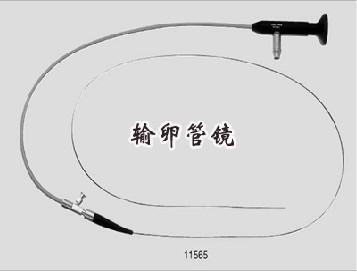 输卵管导丝后多久可以怀孕(输卵管造影多少钱大概多少钱）