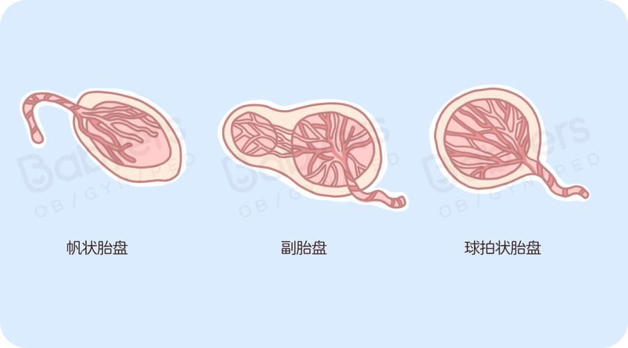 胎盘为什么会粘连(胎盘粘连常见吗）