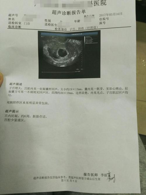 输卵管堵塞有征兆吗这五种情况警示输卵管出了问题(输卵管闭塞）