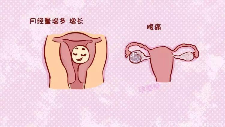 输卵管肿大影响怀孕吗(输卵管堵塞会排卵不）