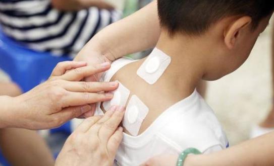 贴三伏贴能吃炸鸡吗(贴了三伏贴能吃炸串吗）