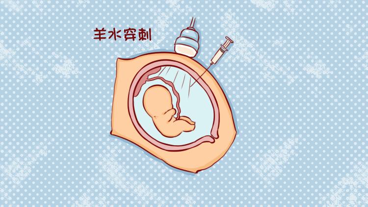 羊膜腔穿刺应该注意什么？(羊膜腔穿刺术指征）