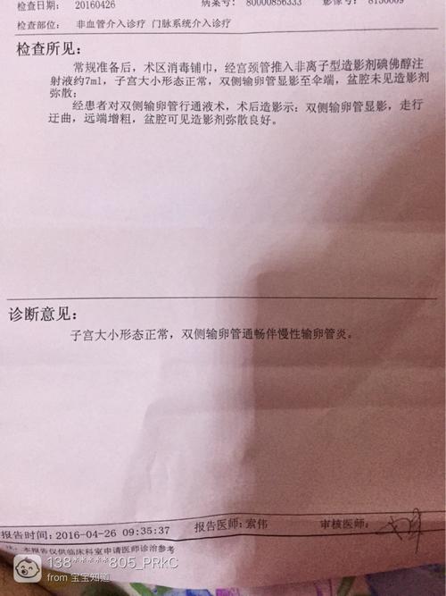 输卵管造影怎么做(输卵管造影正常结果图）