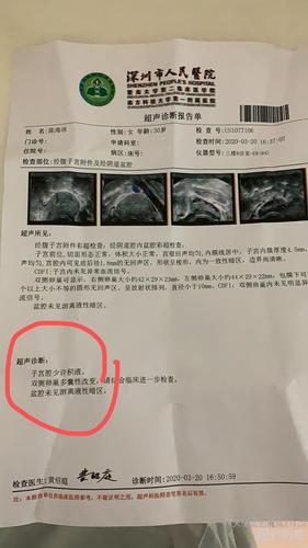 轻度宫腔粘连可以怀孕吗(宫腔粘连最明显的症状）