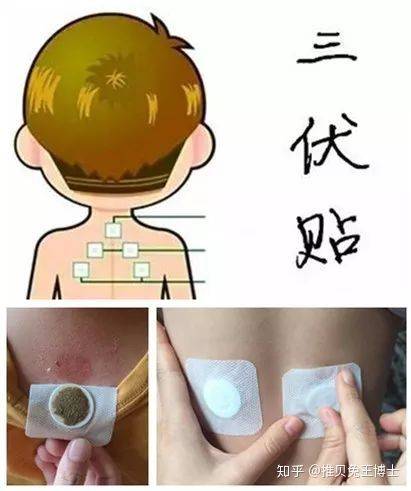 贫血的人可以贴三伏贴吗(三伏贴可以治疗什么）