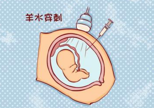 羊膜腔穿刺应该注意什么？(羊膜腔穿刺术指征）