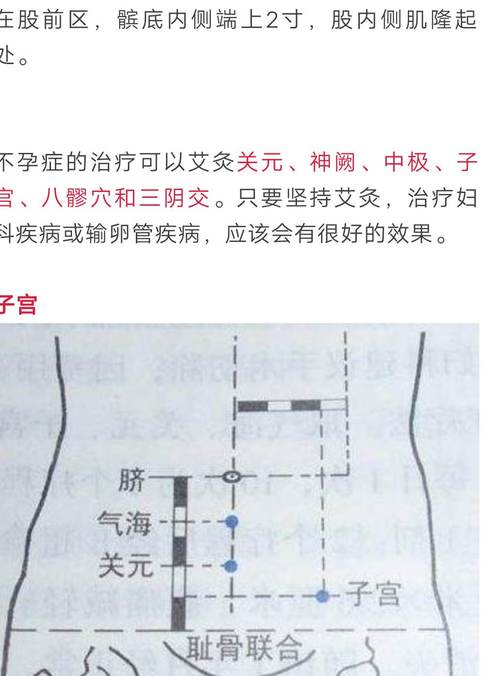 艾灸肚子会导致不孕吗