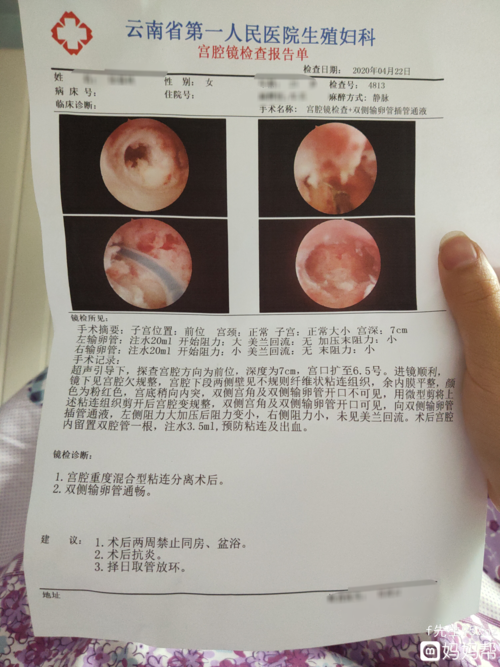 轻度宫腔粘连需要手术吗(子宫粘连一定要做手术吗)