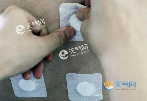 贴三伏贴可以吃龙眼果吗(三伏贴贴在什么位置）