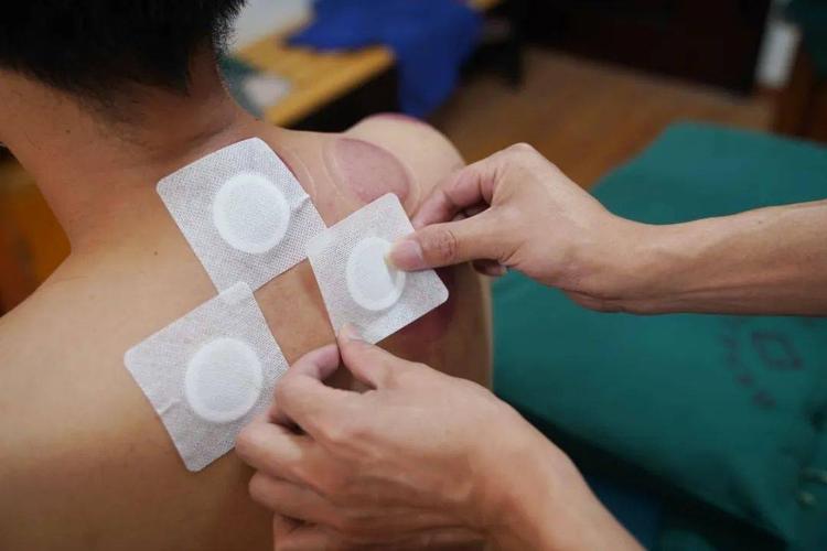 贴三伏贴能吃辣的吗(贴三伏贴能洗澡吗)