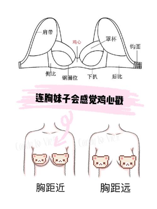 胸外扩是什么样子的(15岁胸型外扩是什么样子）