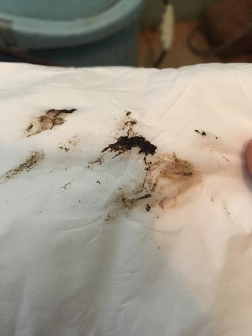 非经期出血褐色超过7天是怎么回事(月经前5-8天有褐色分泌物）