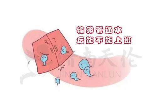 输卵管通液是什么意思(输卵管通水过程图片）