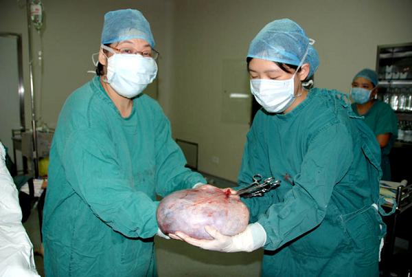 附件囊肿需要做手术吗(女性左侧附件囊肿如何治疗）