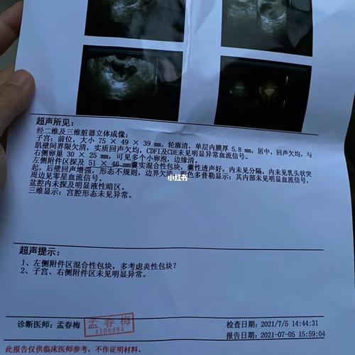 输卵管系膜囊肿会复发吗(输卵管囊肿能怀孩子吗）