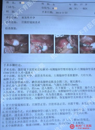 输卵管系膜囊肿是什么(输卵管系膜囊肿手术）