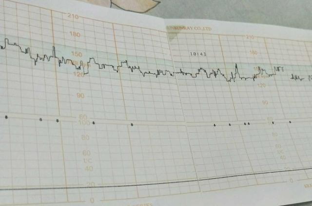 胎心率是怎么看男女的胎心率和宝宝性别有关吗(胎心率150是男孩还是女孩)
