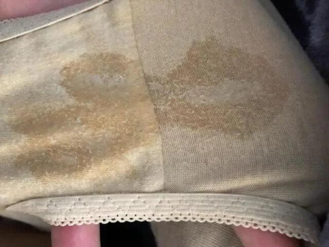 胖人怀孕有什么危害(摸一个地方就知道怀没怀孕）