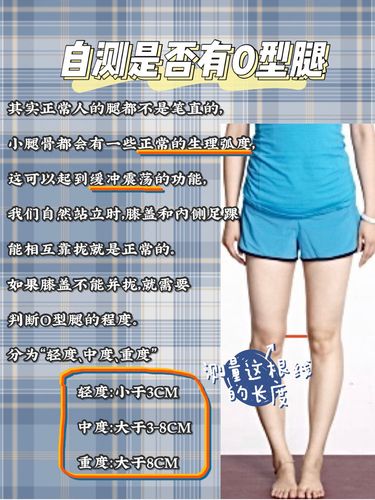 罗圈腿会不会遗传罗圈腿是遗传病吗？(o型腿会遗传给下一代吗）