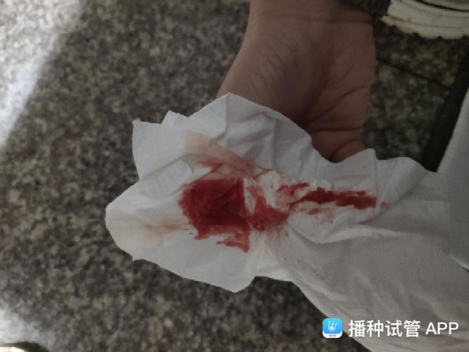 让月经量增多的方法(生理期出血量大怎么办）