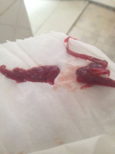 非经期出血有血块流出是什么原因(月经来血块是什么原因）