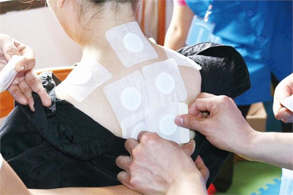 贴三伏贴可以吃小龙虾吗(三伏贴忌口是忌口一伏天吗）