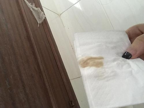 非经期少量出血咖啡色一样吗(月经8至10天还有咖啡色）