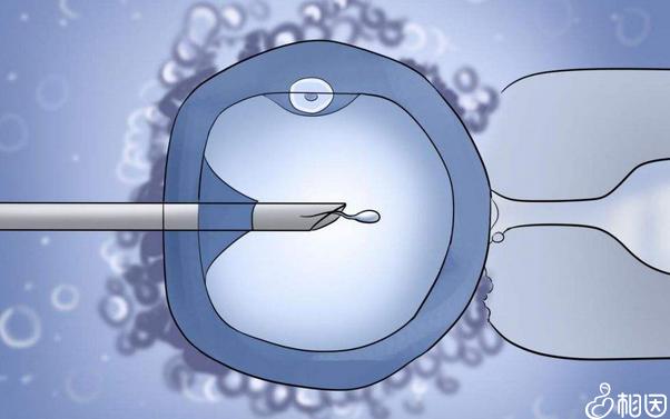 试管婴儿二代的利弊有哪些(试管婴儿90%不是自己的）
