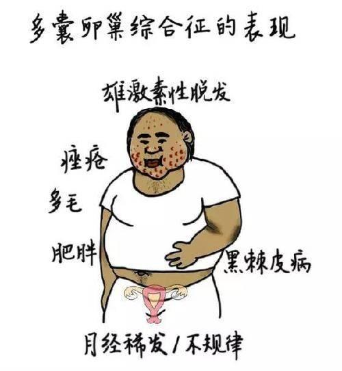 雄性激素偏高是多囊吗多囊跟雄性激素有什么关系？(雄性激素高会导致多囊吗）