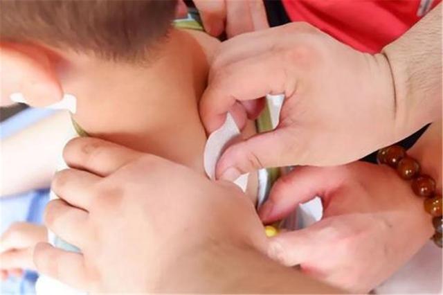 贴三伏贴能去体内湿气吗(儿童贴三伏贴有用吗）