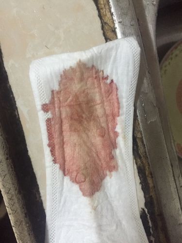 连续10天同房会怀孕吗(连续同房一个星期会怀孕吗）