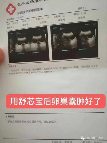 附件囊肿是怎么形成的(附件上长囊肿是什么原因）