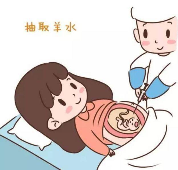 羊膜腔穿刺应该注意什么？(羊膜腔穿刺术指征）