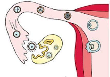 输卵管堵塞会排卵吗(输卵管不通最明显症状)