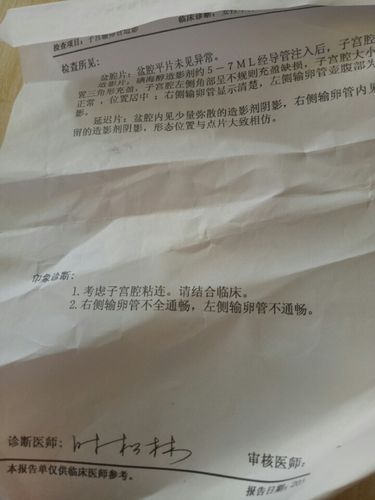 输卵管炎会腹痛吗(输卵管积水跳绳好了）