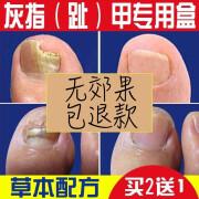 美甲多久后可以怀孕(怀孕三个月做一次美甲没事吧）