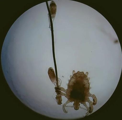 阴虱的虫卵藏在哪里阴虱卵真的在毛囊里吗？(阴虱卵是在毛囊里面吗）