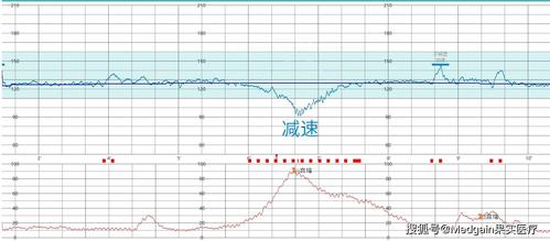 胎心率是怎么看男女的胎心率和宝宝性别有关吗(胎心率150是男孩还是女孩)