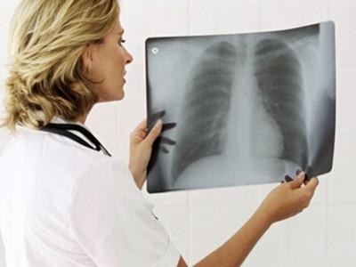 胸透后多久可以怀孕(7月胸透8月怀孕了）