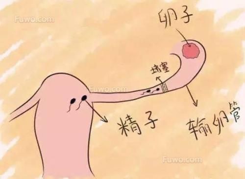 输卵管通水什么时候做最好(做子宫造影需要多少钱）