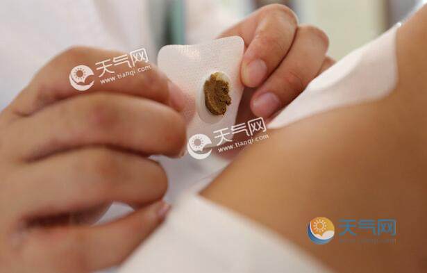 贴三伏贴可以喝奶茶吗(三伏贴可以贴肚脐吗)